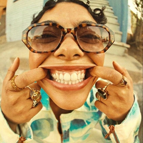 Paciente sonriendo tras procedimiento estético dental en Clínica Rosenberg Santiago