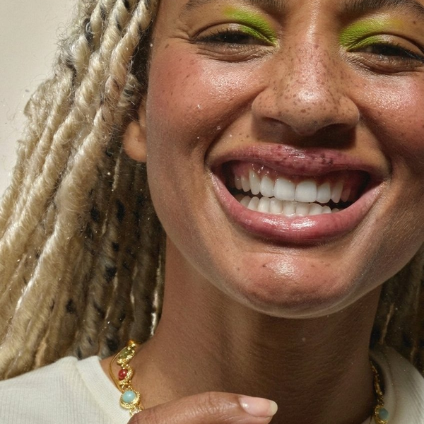 Resultado de diseño de sonrisa con carillas dentales en Santiago